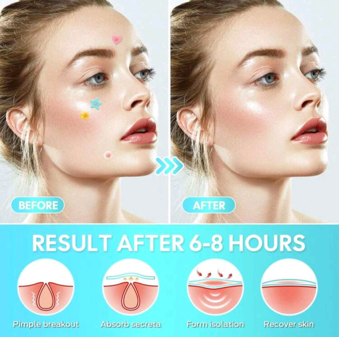 1400 Pcs Star Pimple Patches for Face - Hydrocolloid Acne Blemish Pimple Patches Cute Stars - Glitter, Regular, Glow in the Dark